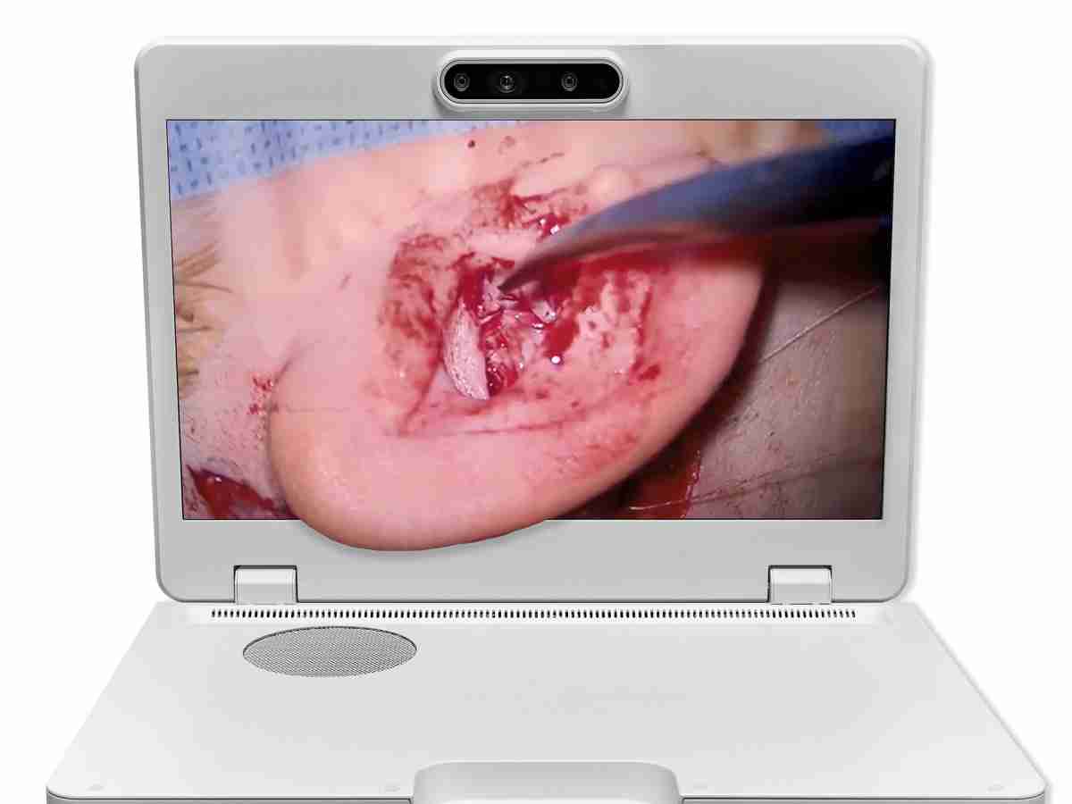 达擎之＂Heads-up 3D显微手术显示系统＂，，，，整合4K裸眼3D显示及眼球追踪系统，，，，具备快速追踪人眼移动位置功能，，减轻医师长时间维持固定姿势的负担，，，，让医师能有更宽广清晰的3D立体视野及更舒适的姿势来执行手术。。